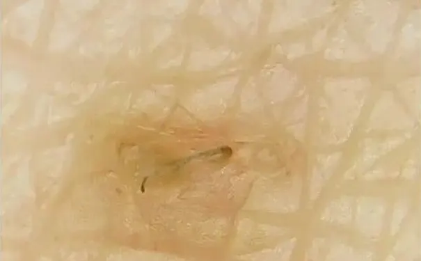 杭州博养压疮治疗中心 杭州博养压疮治疗中心