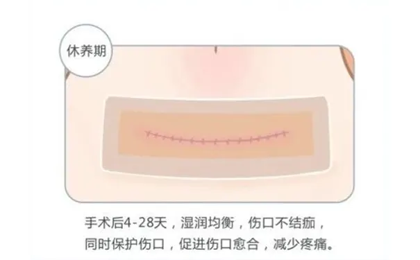 杭州博养压疮治疗中心 杭州博养压疮治疗中心