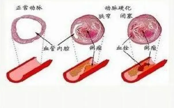 杭州博养压疮治疗中心