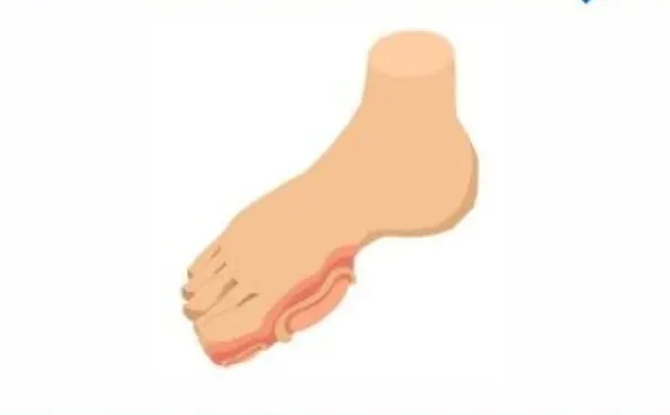 杭州博养压疮治疗中心