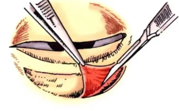 杭州博养压疮治疗中心