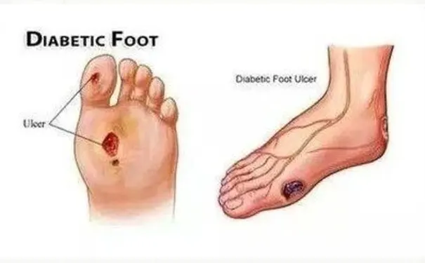 杭州博养压疮治疗中心