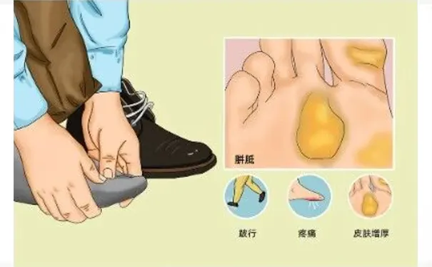 杭州博养压疮治疗中心