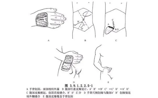 杭州博养压疮治疗中心