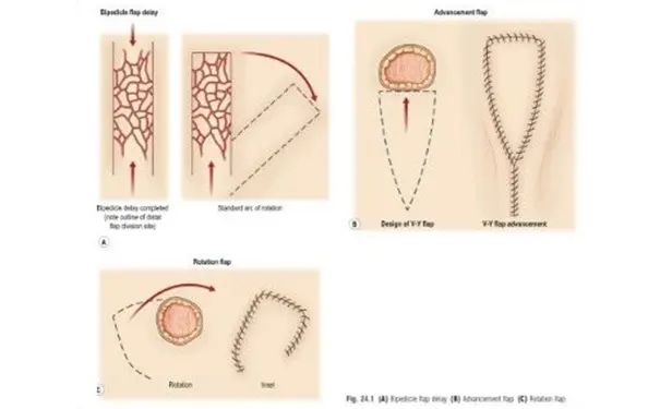 杭州博养压疮治疗中心