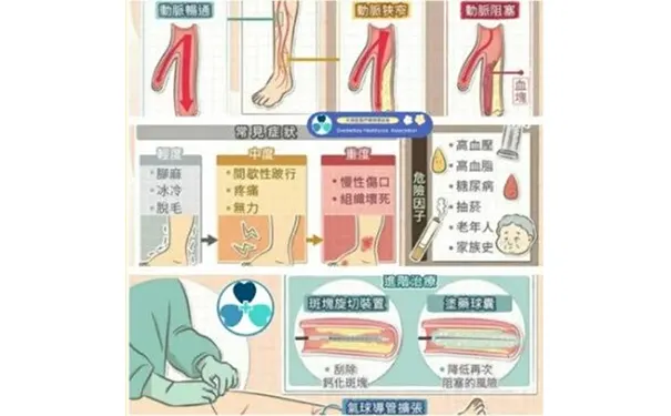 杭州博养压疮治疗中心