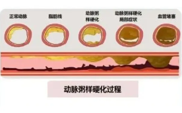 杭州博养压疮治疗中心