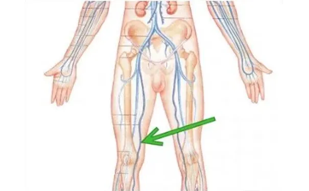 杭州博养压疮治疗中心