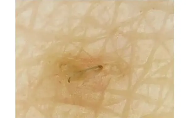 杭州博养压疮治疗中心