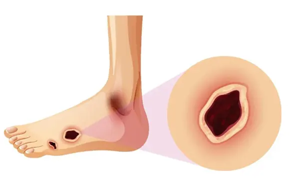 杭州博养压疮治疗中心